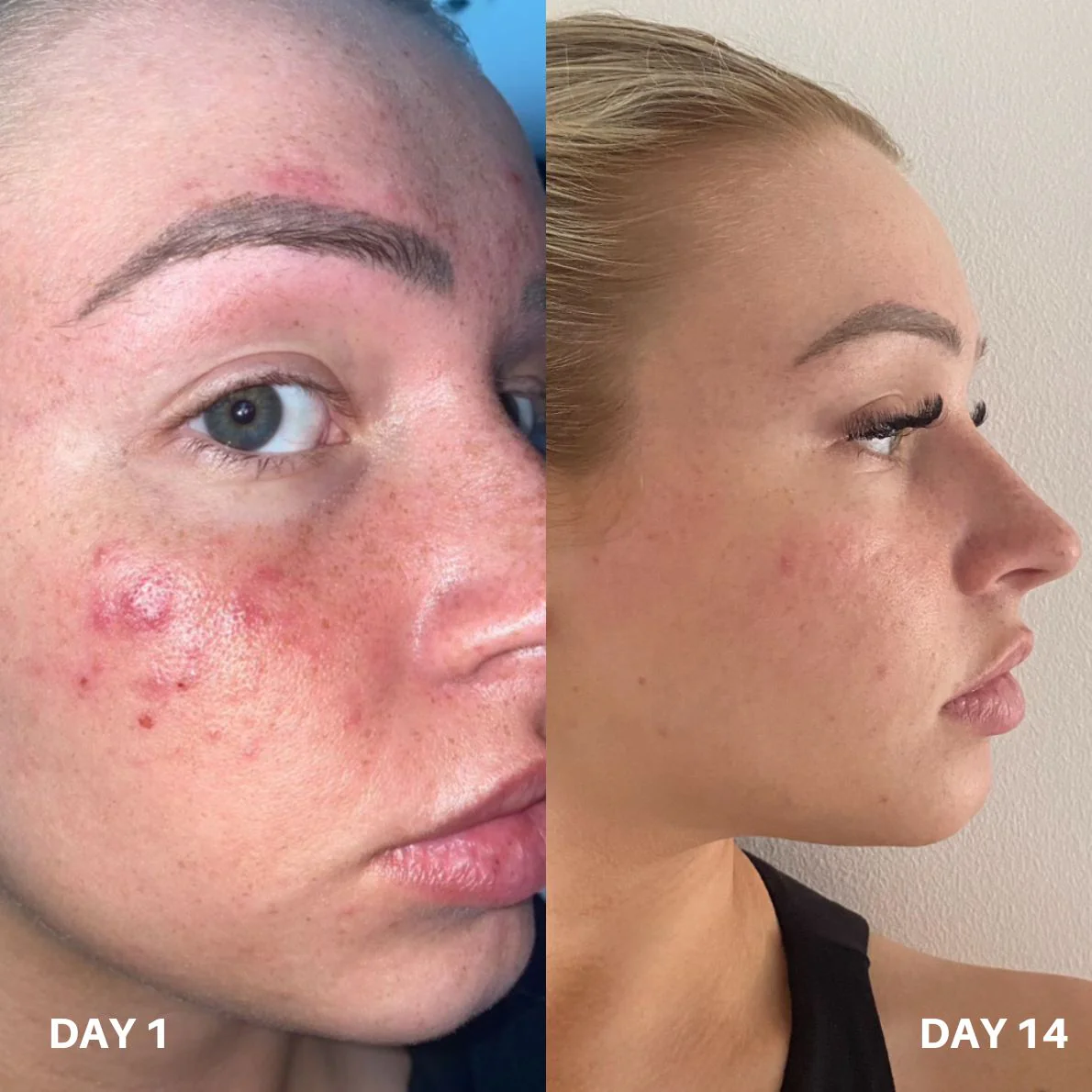 Clinisoothe+ Skin Purifier 250ML - Image 8