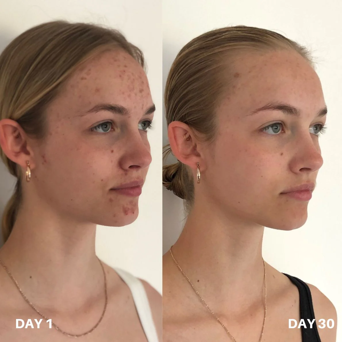 Clinisoothe+ Skin Purifier 100ML - Image 6