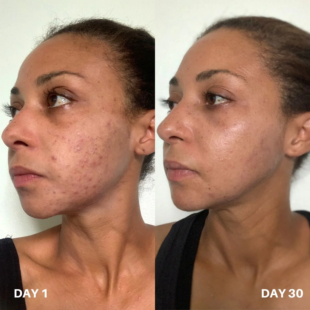 Clinisoothe+ Skin Purifier 100ML - Image 7